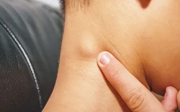 Skin and Soft Tissue Oncology Surgeries